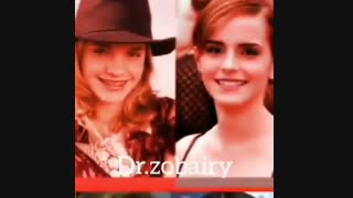 تاثیر کامپوزیت بر چهره بازیگران هالیوودی