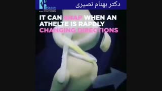 جراحی بازسازی رباط صلیبی