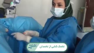 تخمک کشی از تخمدان ها