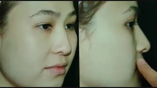 عمل بینی | دکتر امید ابراهیمی