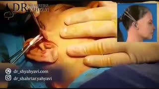 جراحی های همزمان به روی صورت