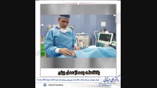 فیلم عمل زیبایی بینی