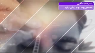 فیلم تزریق بوتاکس جرمگیری