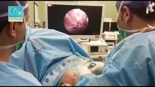 نمونه عمل شانه