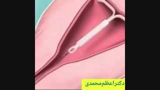 انیمیشنی جذاب از آی یودی