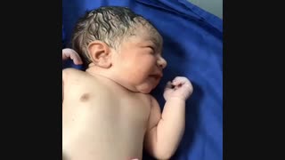 فیلم زایمان نوزاد توسط دکتر مژده نامداری لیپوماتیک