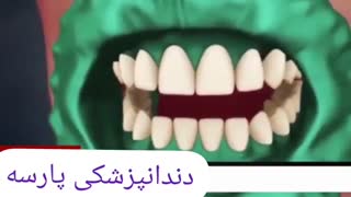 انیمیشن بلیچینگ و سفید کردن دندان اینسایزینگ