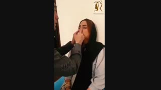 ماساژ بینی بعد از عمل