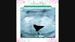 عکس رنگی رحم