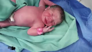 عمل جراحی سزارین