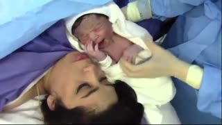 عمل زایمان سزارین