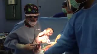 عمل جراحی سزارین توسط دکتر حاجیها