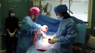 زایمان سزارین در تهران