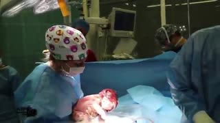 فیلم زایمان سزارین