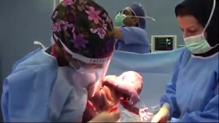 فیلم زایمان سزارین