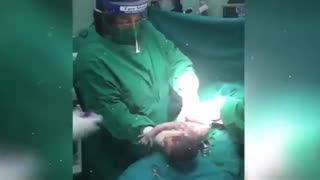 فیلم سزارین دکتر الهام قلی پور