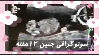 ویدئو جنین ۱۲ هفته ای