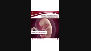 آزمایشات غربالگری سه ماهه اول