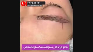 میکروپگمنتیشن