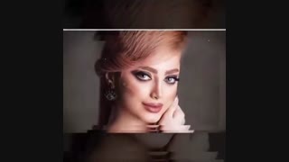 نمونه کار های بهترین جراح بینی دکتر شهریار یحیوی