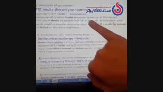 وزوز گوش - سمعک برتر 02122909216