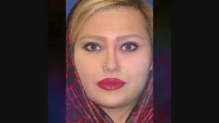 جراحی بینی با فرم طبیعی