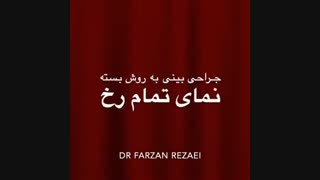 جراحی بینی طبیعی