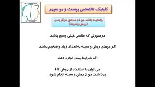 مناسب ترین روش پیوندمو