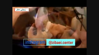 هایفوتراپی