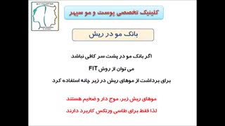 بانک مو در کاشت موی طبیعی