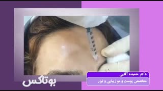 تزریق بوتاکس و ژل