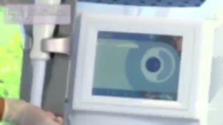 روش کار دستگاه لیزر مدیواستار