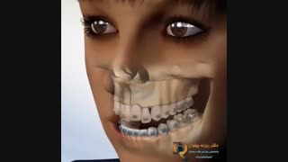 فیلم جراحی فک