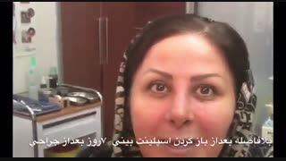 فیلم عمل جراحی زیبایی بینی در اتاق عمل