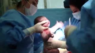 زایمان سزارین توسط دکتر ندا حاجیها