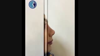 جراحی بینی به روش بسته