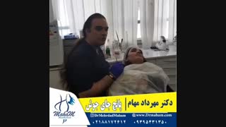 درمان جای جوش با پانج