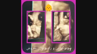 تصویر چهار بعدی صورت جنین