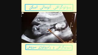 فیلم انومالی اسکن همراه با توضیحات خانم دکتر