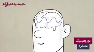 انیمیشن نوروفیدبک