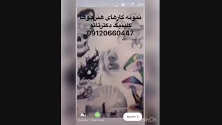 کلینیک تخصصی تاتو | 