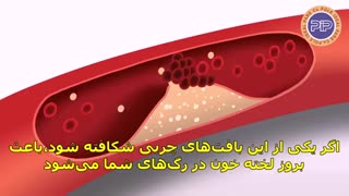 در رابطه با فشار خون بالا بیشتر بدانید