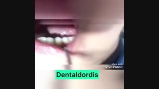 اصلاح طرح لبخند