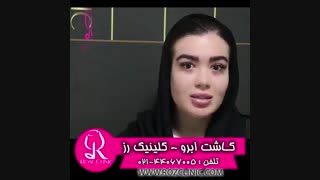 فیلم کاشت ابرو | کلینیک رز | 09104440228 | شماره 198