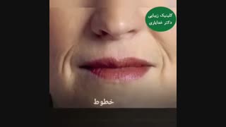 فواید بوتاکس