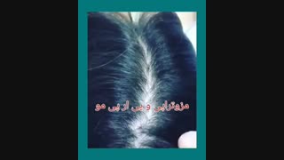 مزوتراپی و پی آر پی مو دکتر خدایاری
