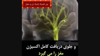 سندرم نوزاد لزران