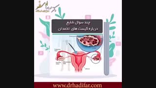 سوالات شایع درباره کیست تخمدان