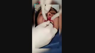 ایمپلنت دندان