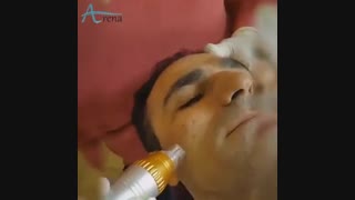 دستگاه آر اف فرکشنال  - آرنا گستر